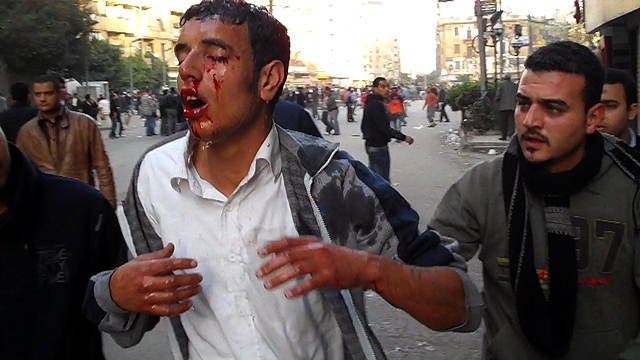 BEEPER: Showdown with Police in Cairo